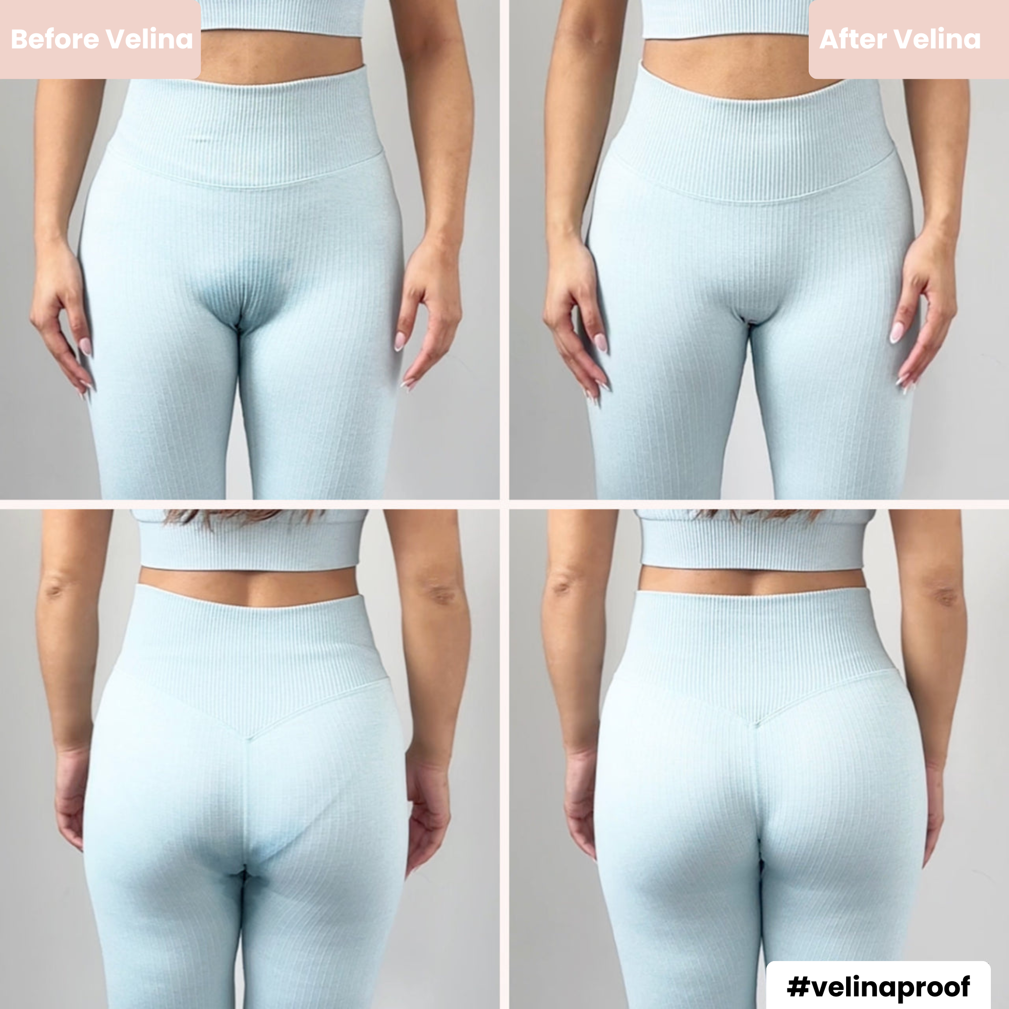 Nuda™ Invisible Camel Toe Thong