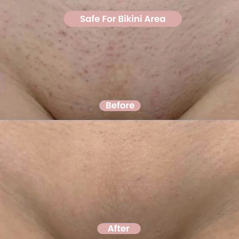 BareBliss™ Shaver