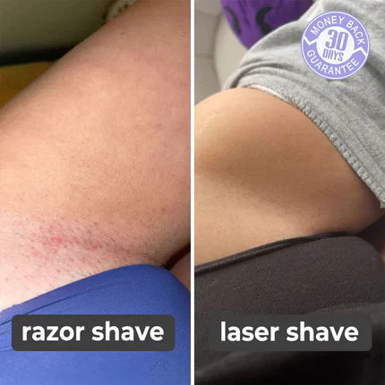 SILK SMOOTH™ - Laser Hair Remover (90% OFF TODAY ONLY!)